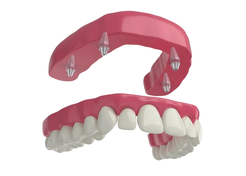 Sonrisa Segura | Dentanova Cínica Odontológica en Ñuñoa